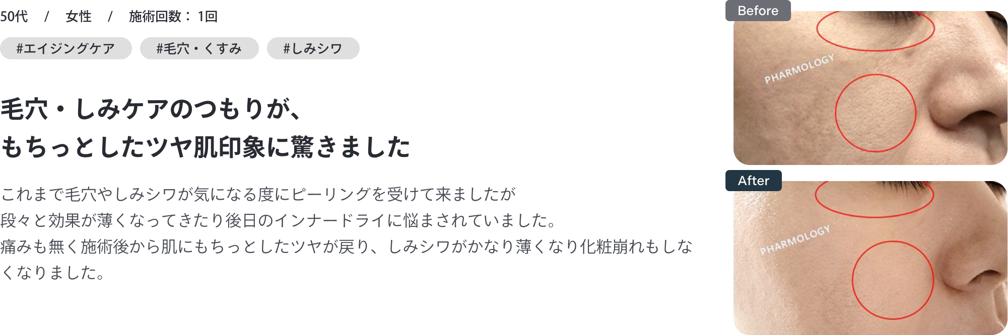 50代・女性｜毛穴・しみケアのつもりが、もちっとしたツヤ肌印象に驚きました